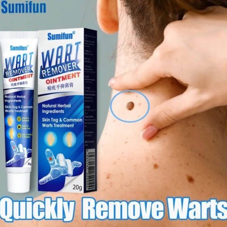 Sumifun Wart Removal Cream 20g